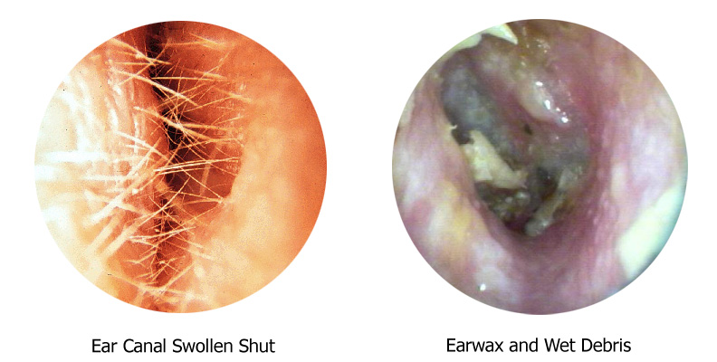 The Appearance of Swimmer's Ear